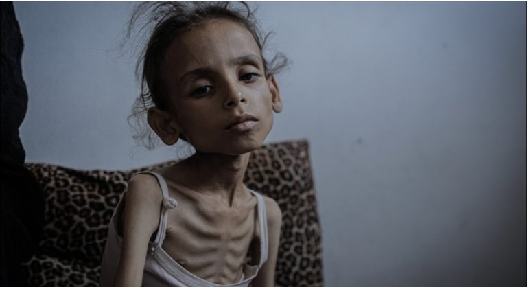 Israel Bayar Google Rp688 Miliar untuk Redam Fakta Kelaparan Warga Gaza